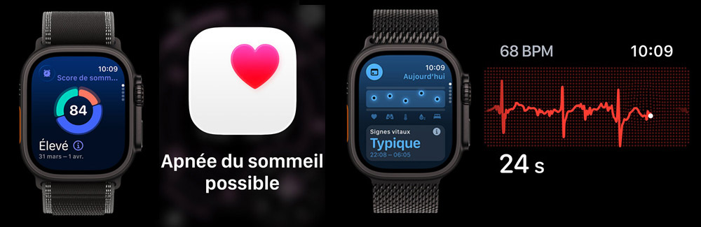 Apple Watch Ultra 3 affichant les écrans de suivi du sommeil, des signes vitaux et de l'électrocardiogramme, avec mention d'apnée du sommeil possible